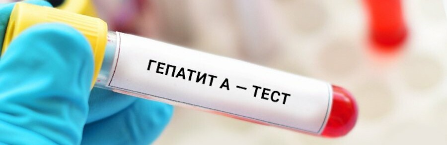 У Броварах зафіксували випадок інфікування вірусним гепатитом А